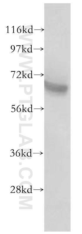 Western Blot (WB) analysis of mouse brain tissue using GRB10 Polyclonal antibody (10027-2-AP)