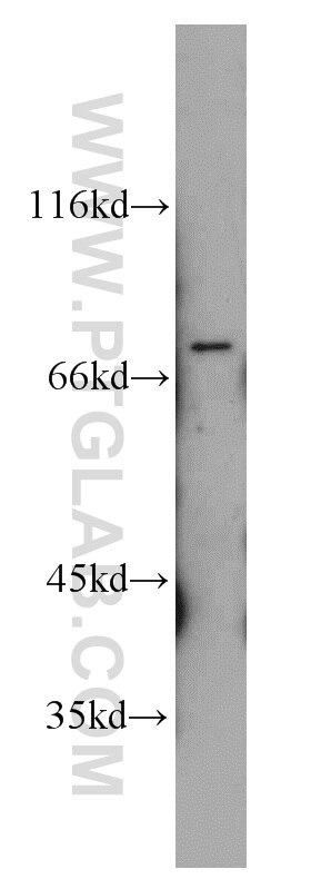 Western Blot (WB) analysis of mouse liver tissue using GRB10 Polyclonal antibody (10028-2-AP)