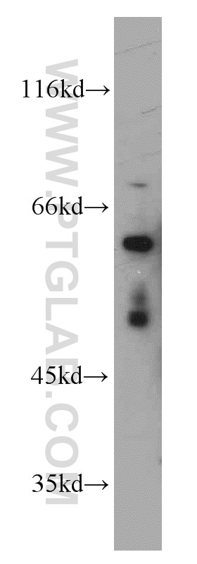 Western Blot (WB) analysis of mouse brain tissue using GRB10 Polyclonal antibody (10028-2-AP)