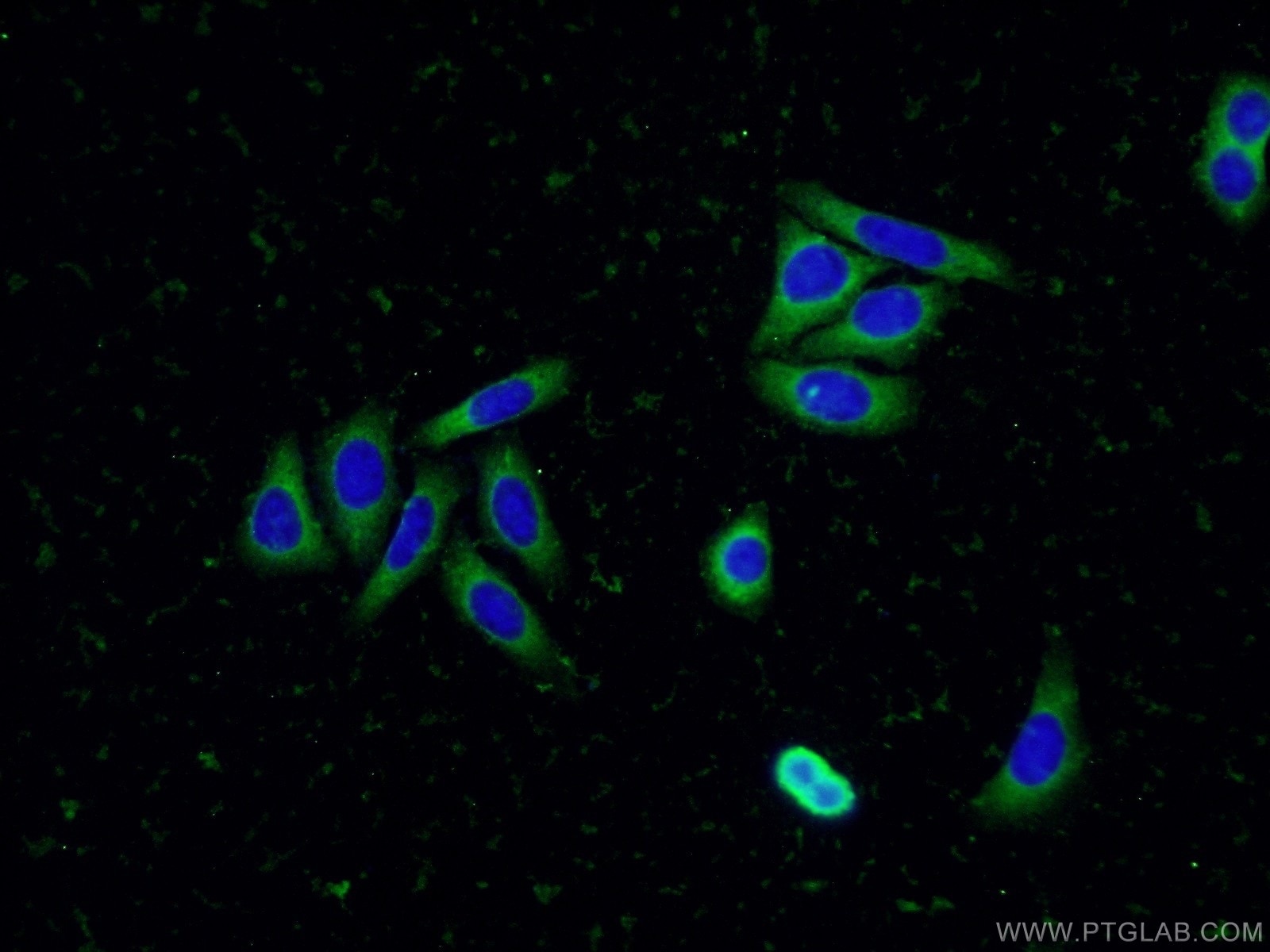 Immunofluorescence (IF) / fluorescent staining of HepG2 cells using GRB10 Polyclonal antibody (16622-1-AP)