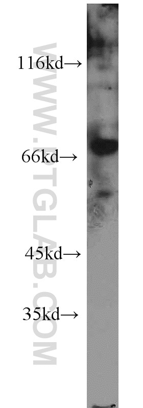 Western Blot (WB) analysis of HepG2 cells using GRB10 Polyclonal antibody (16622-1-AP)