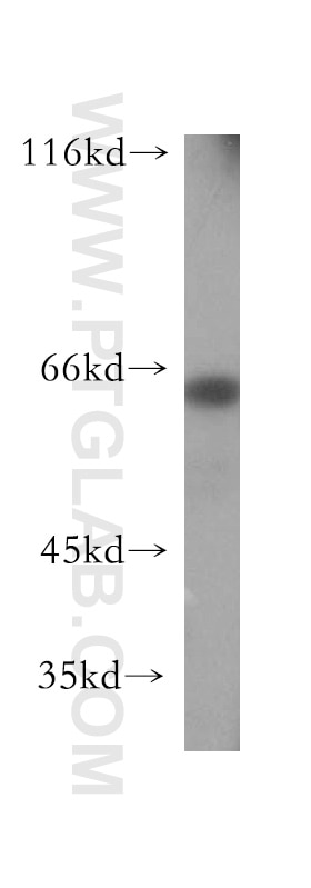 Western Blot (WB) analysis of HepG2 cells using GRB10 Polyclonal antibody (16622-1-AP)