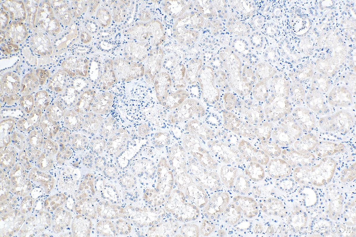 Immunohistochemistry (IHC) staining of human kidney tissue using GRB10 Polyclonal antibody (23591-1-AP)