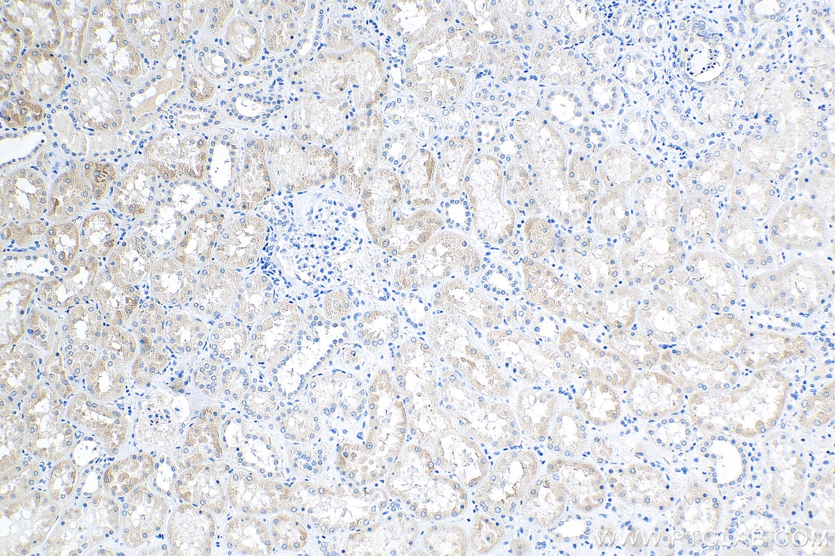 IHC staining of human kidney using 23591-1-AP