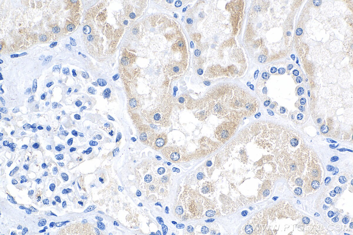 Immunohistochemistry (IHC) staining of human kidney tissue using GRB10 Polyclonal antibody (23591-1-AP)