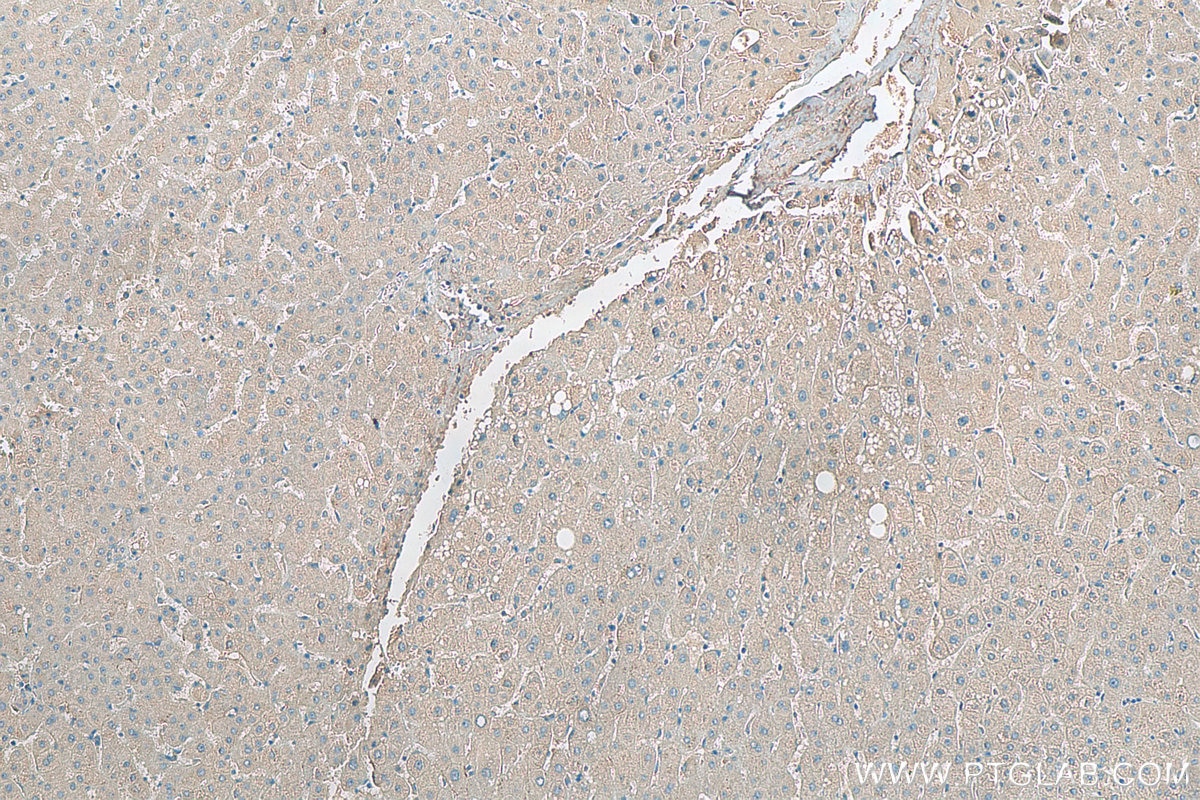 Immunohistochemistry (IHC) staining of human liver tissue using GRB10 Polyclonal antibody (23591-1-AP)