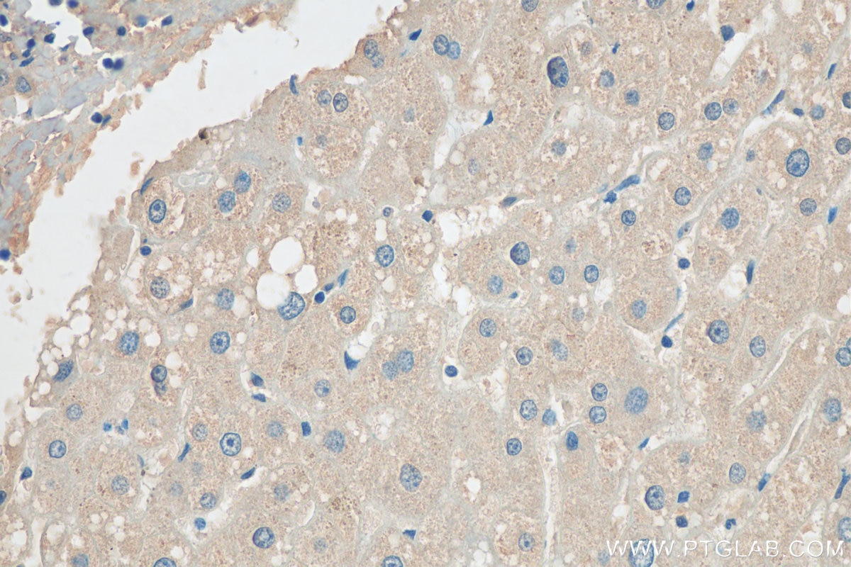 Immunohistochemistry (IHC) staining of human liver tissue using GRB10 Polyclonal antibody (23591-1-AP)