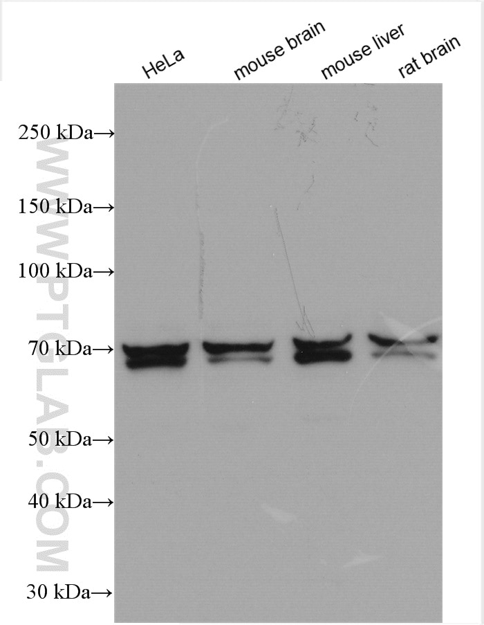 Western Blot (WB) analysis of various lysates using GRB10 Polyclonal antibody (23591-1-AP)