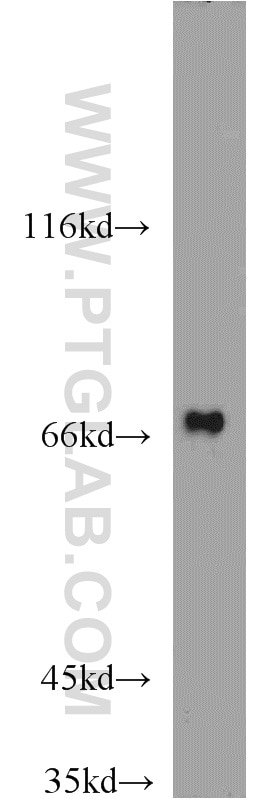 Western Blot (WB) analysis of HepG2 cells using GRB10 Polyclonal antibody (23591-1-AP)