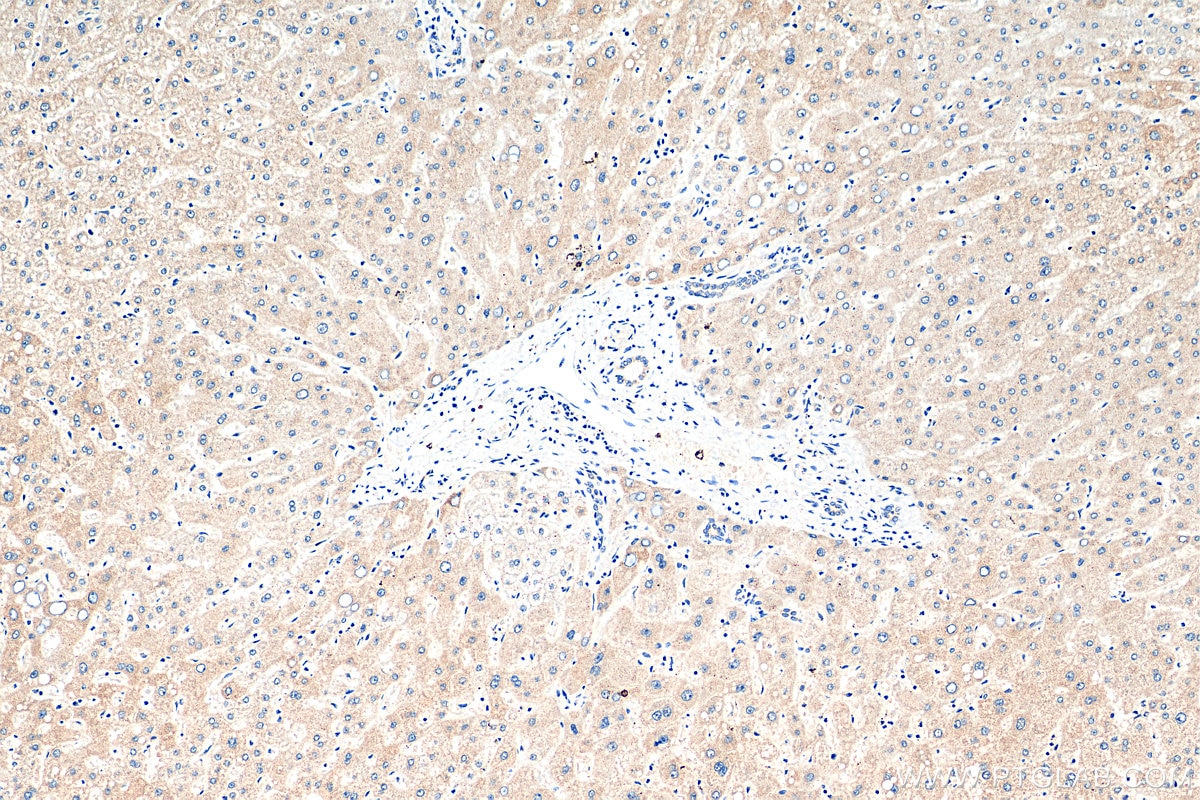 Immunohistochemistry (IHC) staining of human liver tissue using GRB10 Polyclonal antibody (28872-1-AP)
