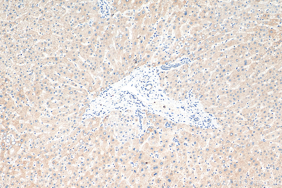 IHC staining of human liver using 28872-1-AP