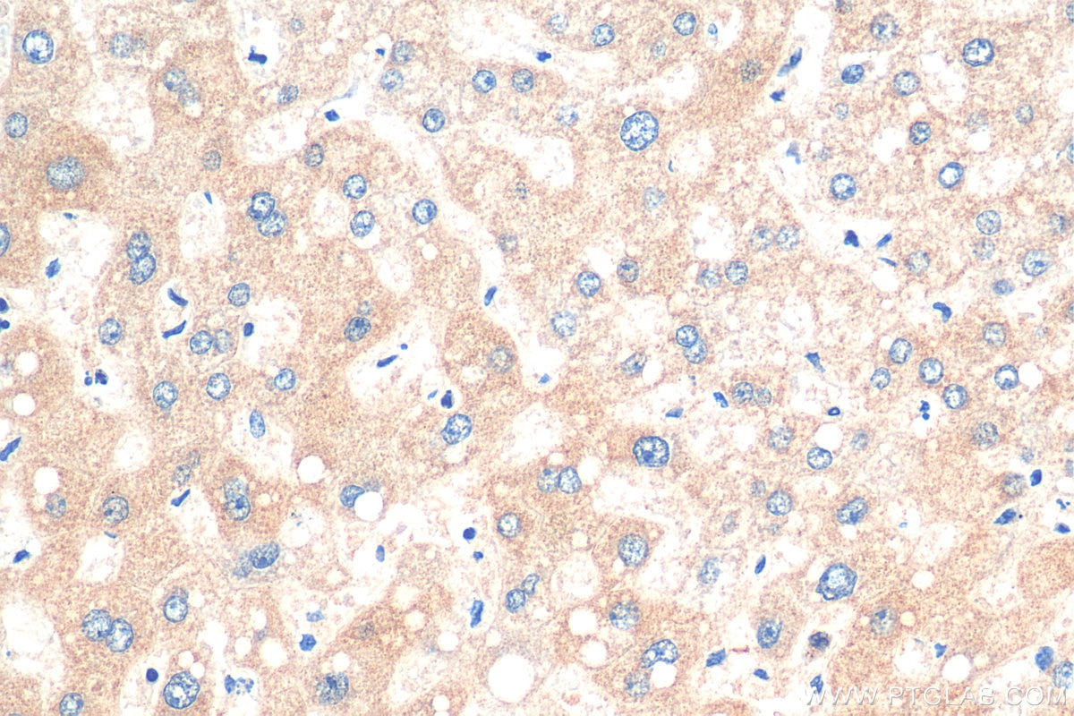 IHC staining of human liver using 28872-1-AP