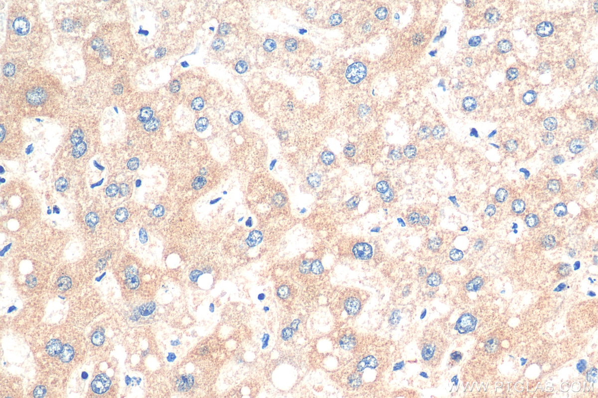 Immunohistochemistry (IHC) staining of human liver tissue using GRB10 Polyclonal antibody (28872-1-AP)