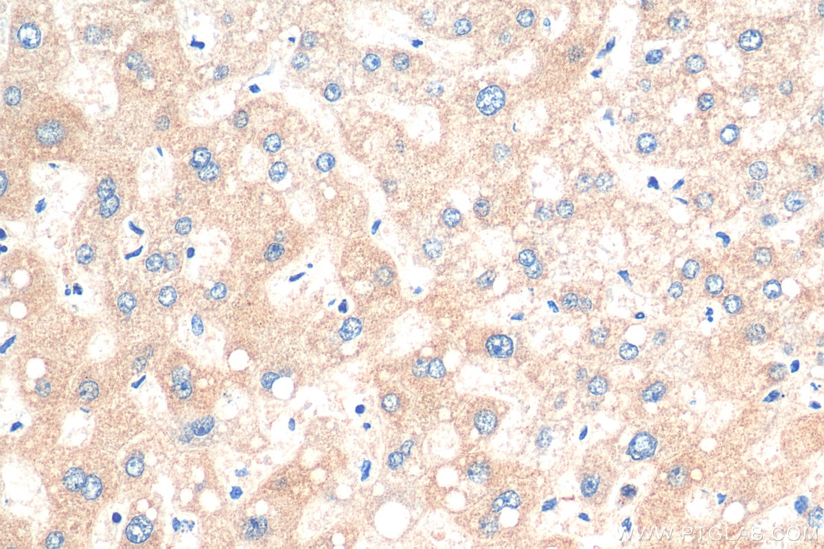 Immunohistochemistry (IHC) staining of human liver tissue using GRB10 Polyclonal antibody (28872-1-AP)