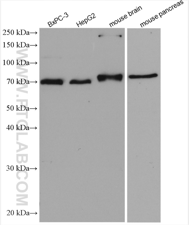 Western Blot (WB) analysis of various lysates using GRB10 Polyclonal antibody (28872-1-AP)