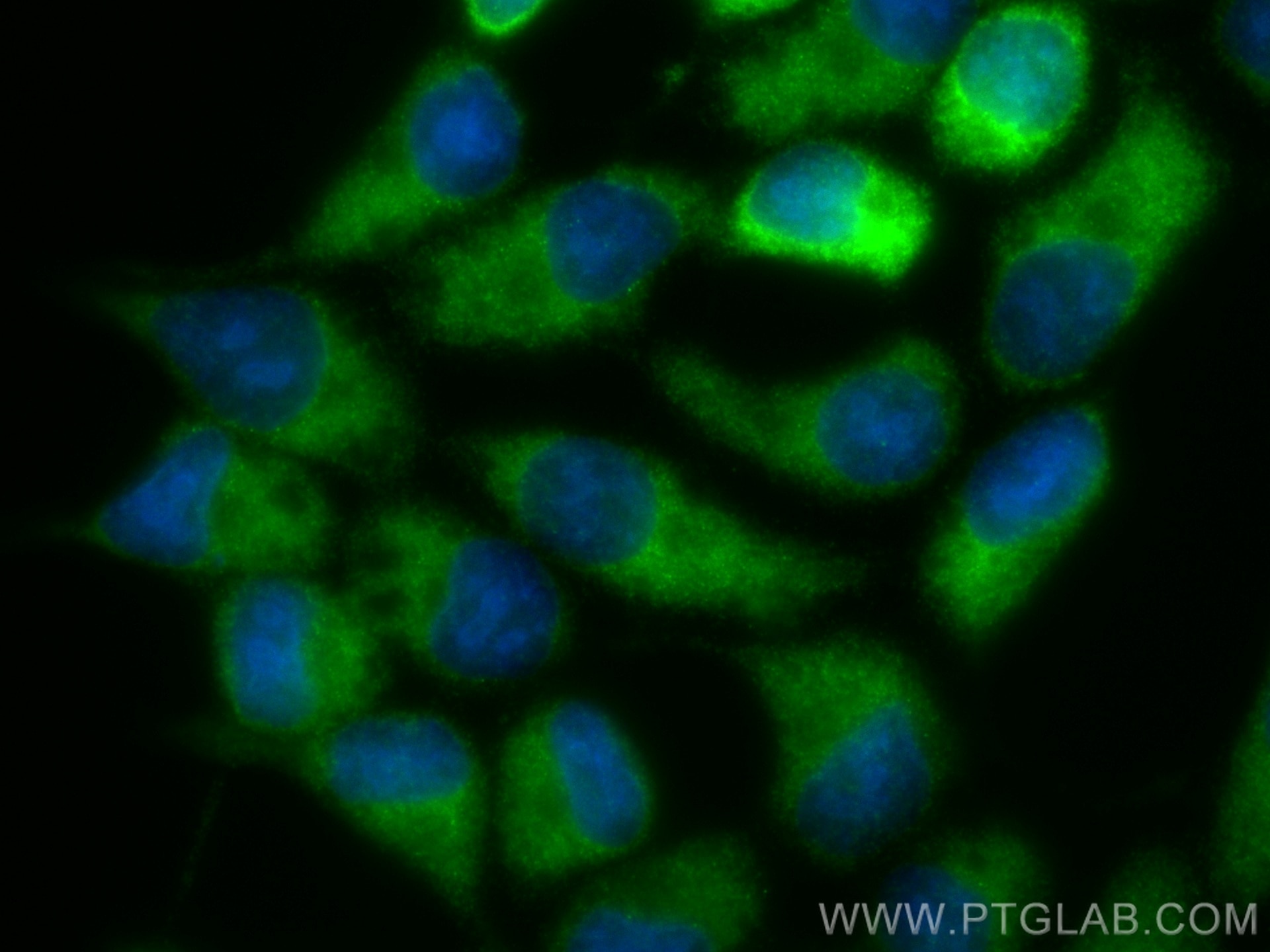 Immunofluorescence (IF) / fluorescent staining of LNCaP cells using GRB10 Recombinant antibody (81225-1-RR)