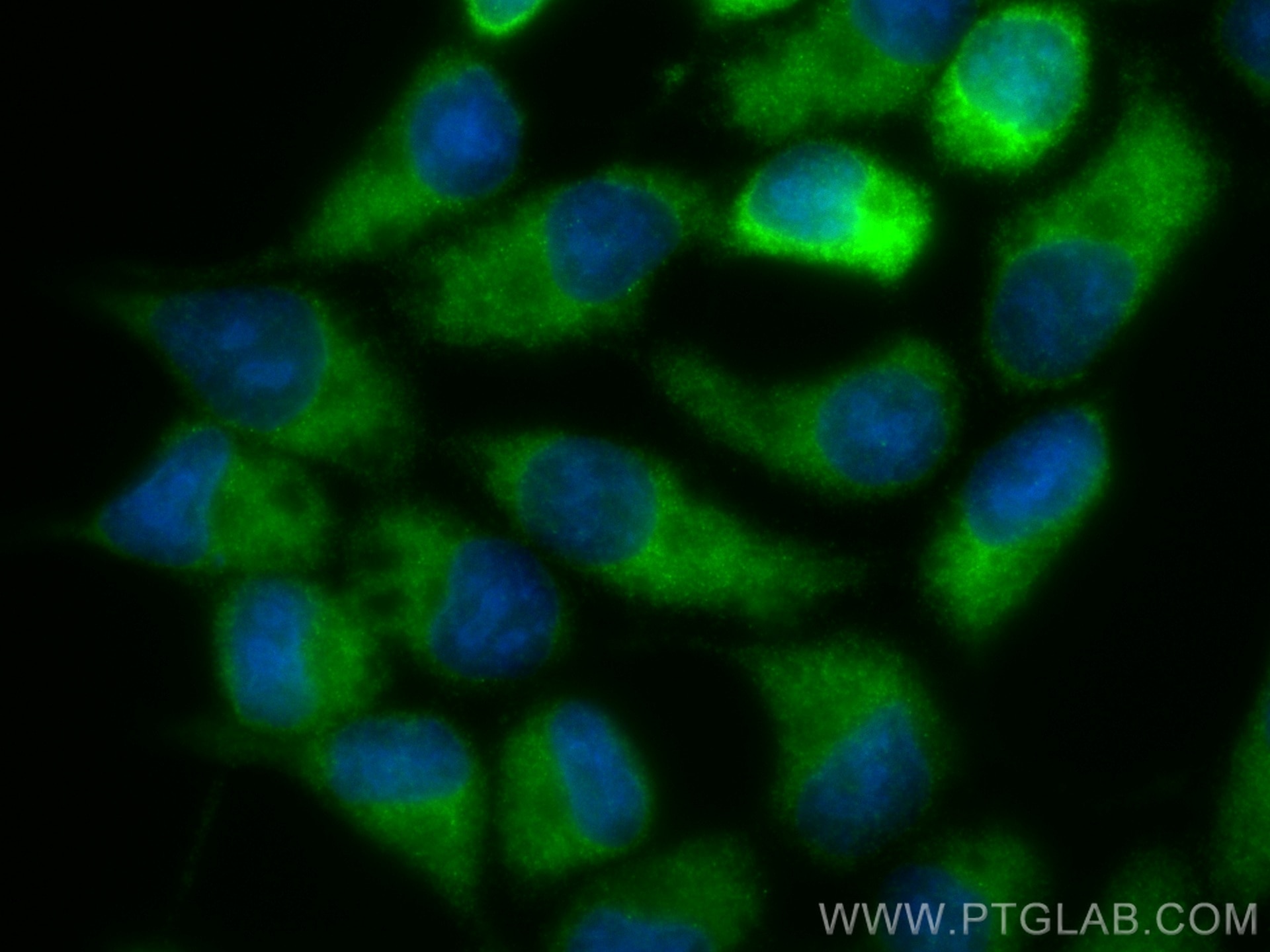 IF Staining of LNCaP using 81225-1-RR