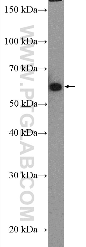 Western Blot (WB) analysis of DU 145 cells using GRB14 Polyclonal antibody (15298-1-AP)