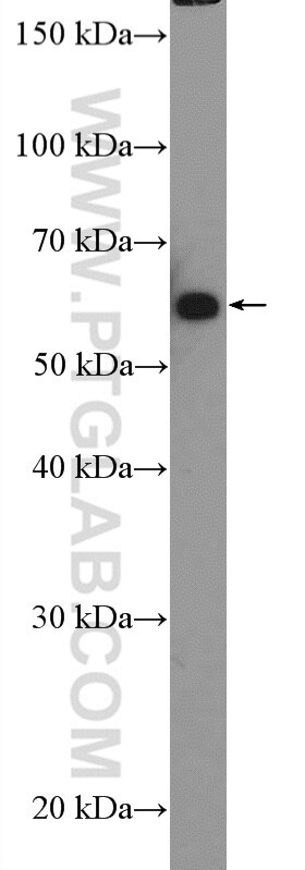 Western Blot (WB) analysis of DU 145 cells using GRB14 Polyclonal antibody (15298-1-AP)