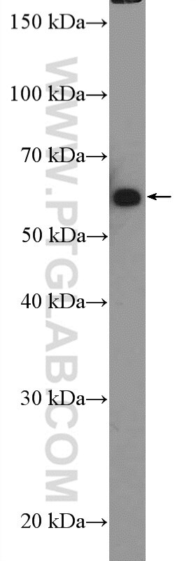 Western Blot (WB) analysis of DU 145 cells using GRB14 Polyclonal antibody (15298-1-AP)