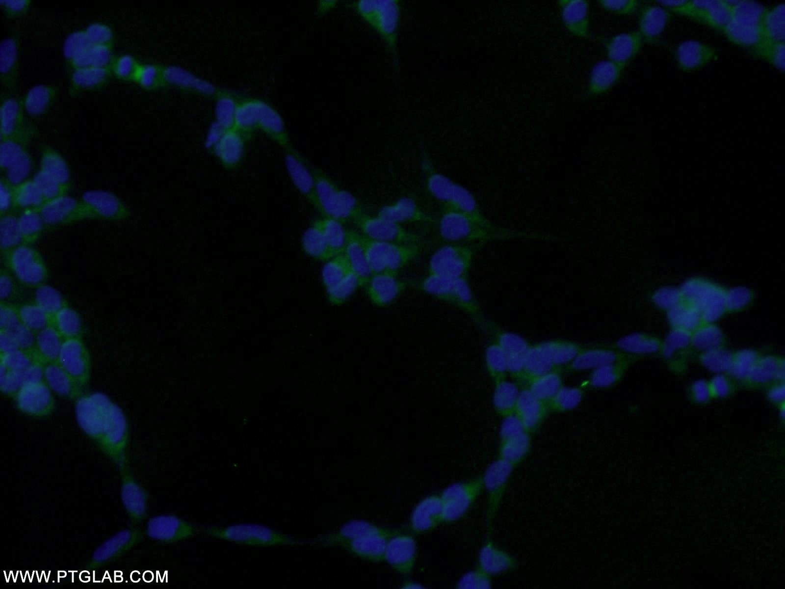 Immunofluorescence (IF) / fluorescent staining of HEK-293 cells using GRB2 Polyclonal antibody (10254-2-AP)