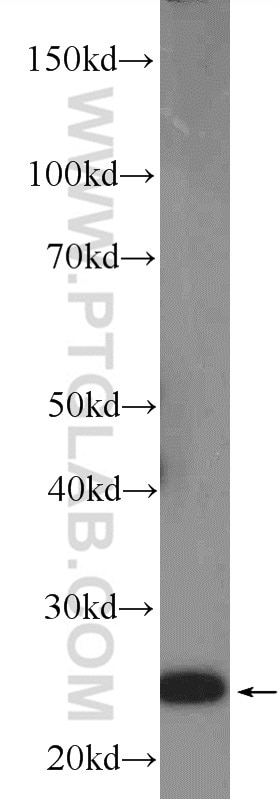 Western Blot (WB) analysis of rat brain tissue using GRB2 Polyclonal antibody (10254-2-AP)