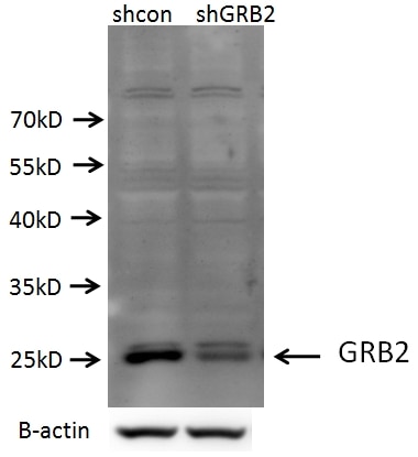 GRB2 Polyclonal antibody