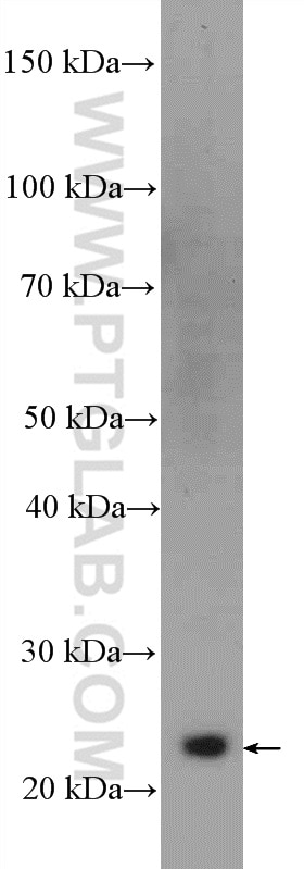 Western Blot (WB) analysis of rat spleen tissue using GRB2 Polyclonal antibody (10254-2-AP)