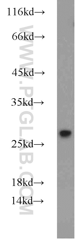 Western Blot (WB) analysis of HEK-293 cells using GRB2 Polyclonal antibody (10254-2-AP)