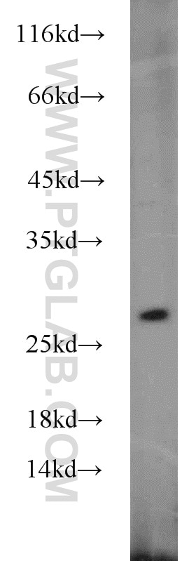 Western Blot (WB) analysis of A431 cells using GRB2 Polyclonal antibody (10254-2-AP)