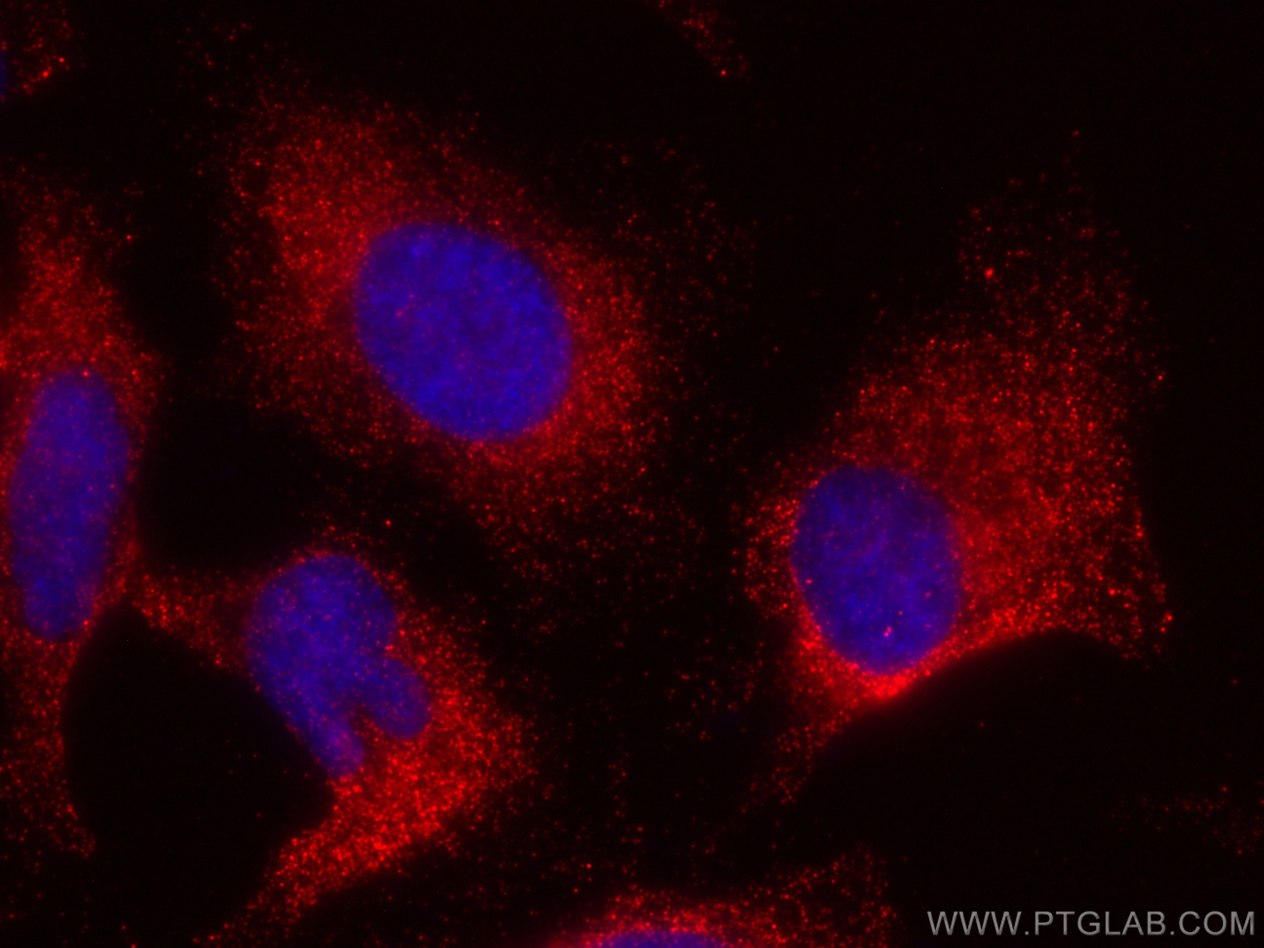 Immunofluorescence (IF) / fluorescent staining of HeLa cells using CoraLite®594-conjugated GRB2 Monoclonal antibody (CL594-66880)