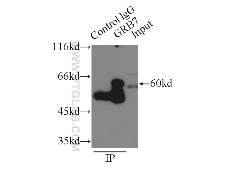 Immunoprecipitation (IP) experiment of A431 cells using GRB7 Polyclonal antibody (10045-1-Ig)