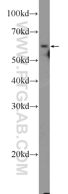 Western Blot (WB) analysis of A431 cells using GRB7 Polyclonal antibody (10045-1-Ig)