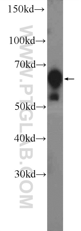 Western Blot (WB) analysis of HEK-293 cells using GRB7 Polyclonal antibody (10045-1-Ig)