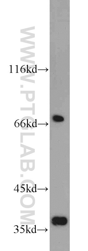 Western Blot (WB) analysis of mouse brain tissue using GRB7 Polyclonal antibody (10045-1-Ig)