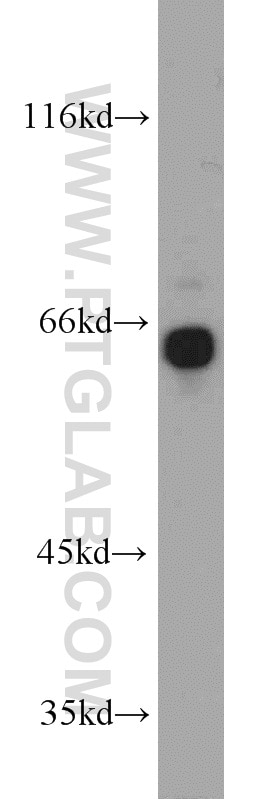 Western Blot (WB) analysis of A431 cells using GRB7 Polyclonal antibody (10045-1-Ig)