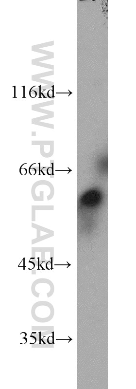 Western Blot (WB) analysis of HEK-293 cells using GRB7 Polyclonal antibody (10045-1-Ig)