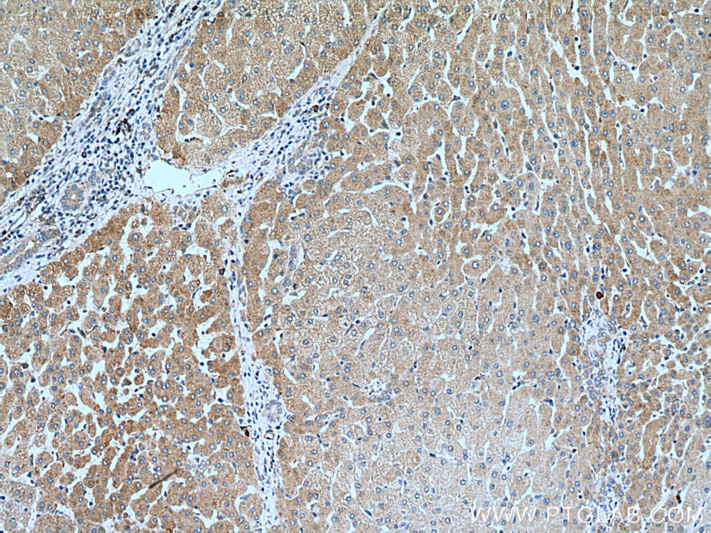Immunohistochemistry (IHC) staining of human liver tissue using GREB1 Polyclonal antibody (28699-1-AP)