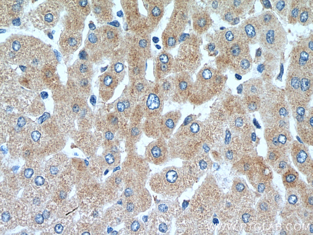 Immunohistochemistry (IHC) staining of human liver tissue using GREB1 Polyclonal antibody (28699-1-AP)
