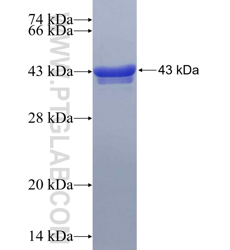 GREB1 fusion protein Ag29908 SDS-PAGE