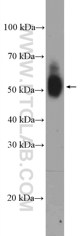 Western Blot (WB) analysis of mouse small intestine tissue using GREM1 Polyclonal antibody (18024-1-AP)