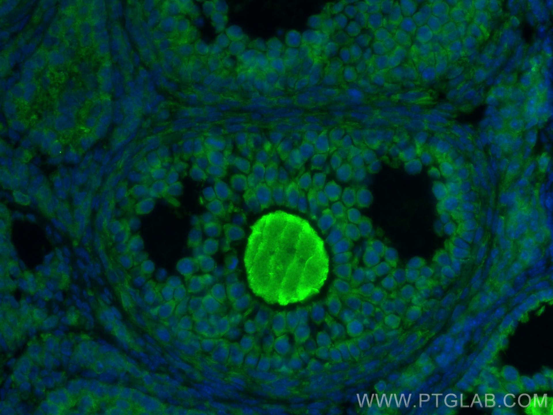 Immunofluorescence (IF) / fluorescent staining of mouse ovary tissue using GREM2 Polyclonal antibody (13892-1-AP)