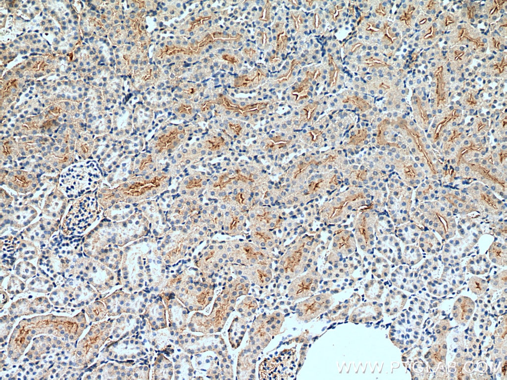 IHC staining of mouse kidney using 13892-1-AP