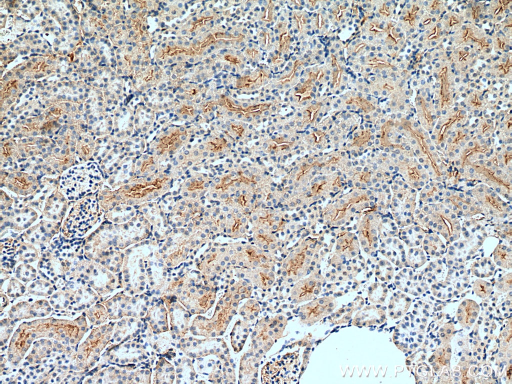 Immunohistochemistry (IHC) staining of mouse kidney tissue using GREM2 Polyclonal antibody (13892-1-AP)