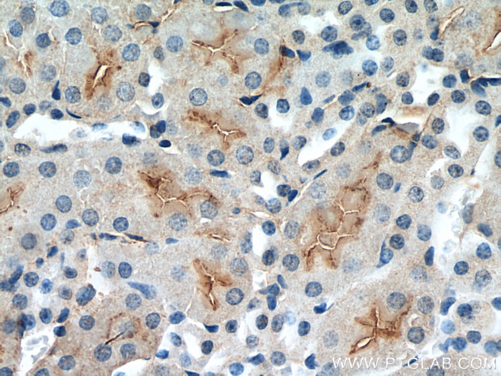 IHC staining of mouse kidney using 13892-1-AP