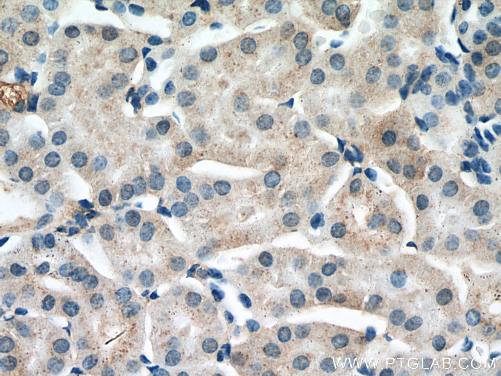 Immunohistochemistry (IHC) staining of mouse kidney tissue using GREM2 Polyclonal antibody (13892-1-AP)
