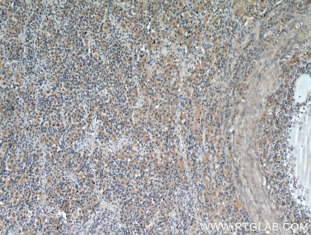 Immunohistochemistry (IHC) staining of human ovary tissue using GREM2 Polyclonal antibody (13892-1-AP)