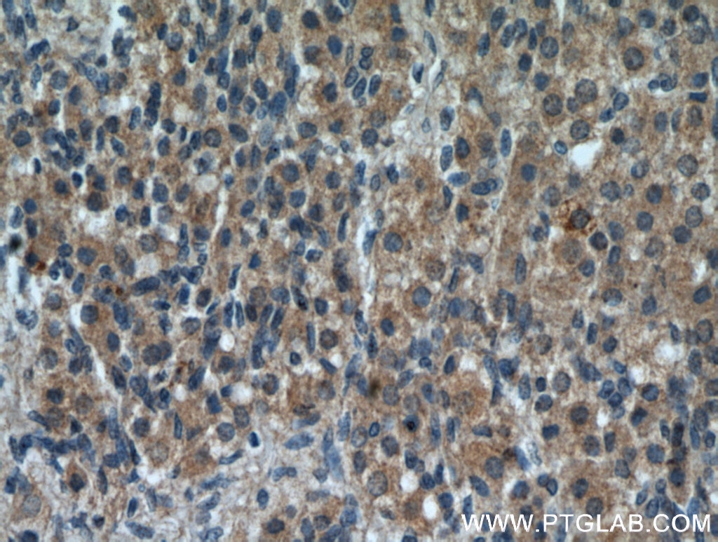 Immunohistochemistry (IHC) staining of human ovary tissue using GREM2 Polyclonal antibody (13892-1-AP)
