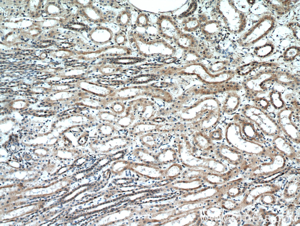 Immunohistochemistry (IHC) staining of human kidney tissue using GREM2 Polyclonal antibody (13892-1-AP)