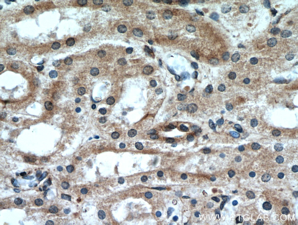 GREM2 Polyclonal antibody